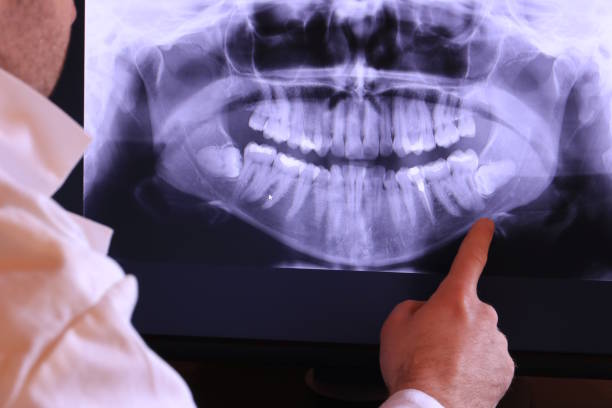 Best Pediatric Emergency Dentist in Jeffersonville, IN